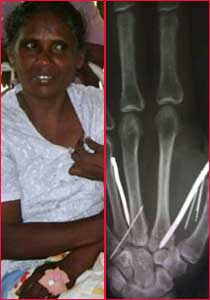 السعودية: سخن مسامير وغرسها بجسد خادمة بواسطة مطرقة! صورة رقم 1