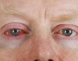 التهاب جماعي في العيون والحلق يغلق أبواب المتحف البريطاني!!  صورة رقم 1