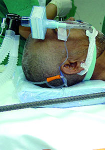 أطباء عرب ينقذون هندي بعد اختراق قضيب حديدي جسده! صورة رقم 1