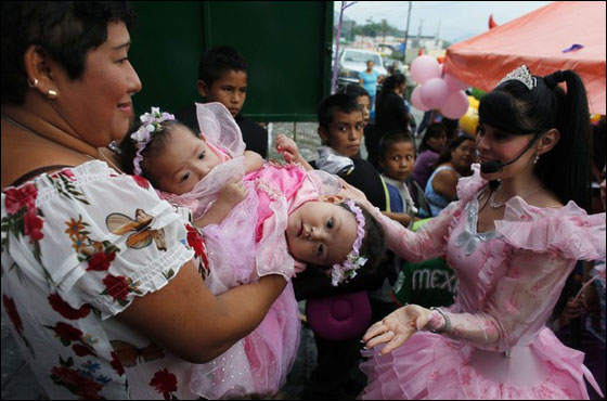 التوأم السيامي ماريا وإلسا تحتفلان بميلادهما الأول قبل فصلهما صورة رقم 5 التوأم السيامي ماريا وإلسا تحتفلان بميلادهما الأول قبل فصلهما صورة رقم 5