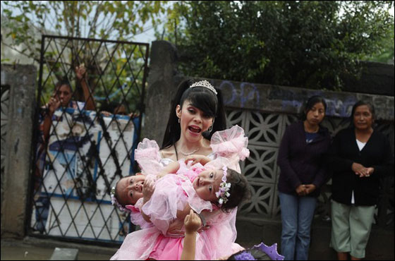 التوأم السيامي ماريا وإلسا تحتفلان بميلادهما الأول قبل فصلهما صورة رقم 6 التوأم السيامي ماريا وإلسا تحتفلان بميلادهما الأول قبل فصلهما صورة رقم 6