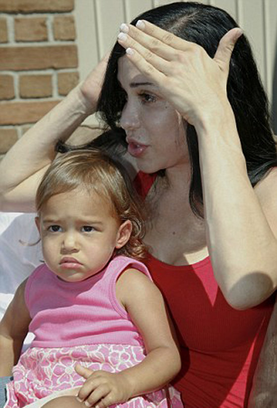 المطالبة بسحب رخصة الطبيب الذي زرع 14 جنينا في رحم أم الثمانية! صورة رقم 6 المطالبة بسحب رخصة الطبيب الذي زرع 14 جنينا في رحم أم الثمانية! صورة رقم 6