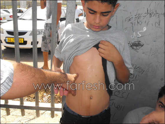 عين ماهل: مواجهات الأمس تزيدنا إصرارا على رفض المديرة  صورة رقم 70