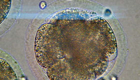 خرق طبي.. ولادة جنين جمد منذ 20 عاما!  صورة رقم 2