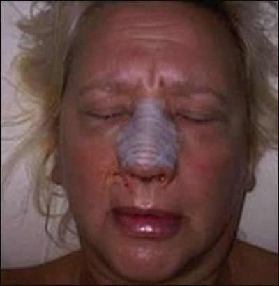 لجميع مصففي الشعر.. احذروا من التهابات الأنف!! صورة رقم 1 لجميع مصففي الشعر.. احذروا من التهابات الأنف!! صورة رقم 1