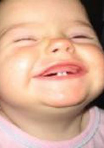 بعد مرور 6 ايام على ولادتها.. وجدوا اسنان في فمها! صورة رقم 1 بعد مرور 6 ايام على ولادتها.. وجدوا اسنان في فمها! صورة رقم 1