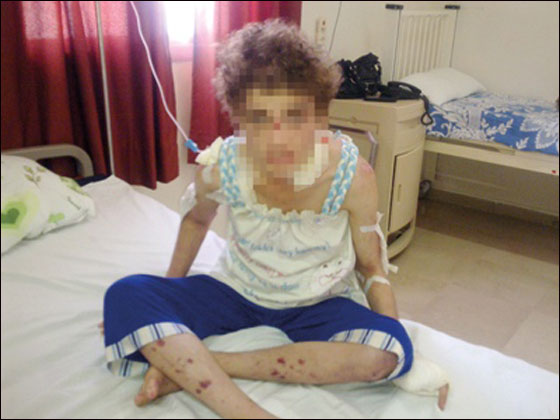 عذاب أشد من القتل.. قصة فتاة ذاقت من والدها عذاب جهنم!!  صورة رقم 4