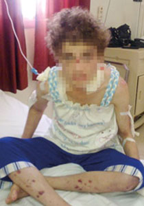 عذاب أشد من القتل.. قصة فتاة ذاقت من والدها عذاب جهنم!!  صورة رقم 1