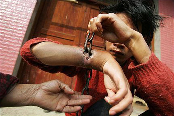 الصين: اما ان يخرج سلسلة من ساعده.. أو يقطع يده!   صورة رقم 1