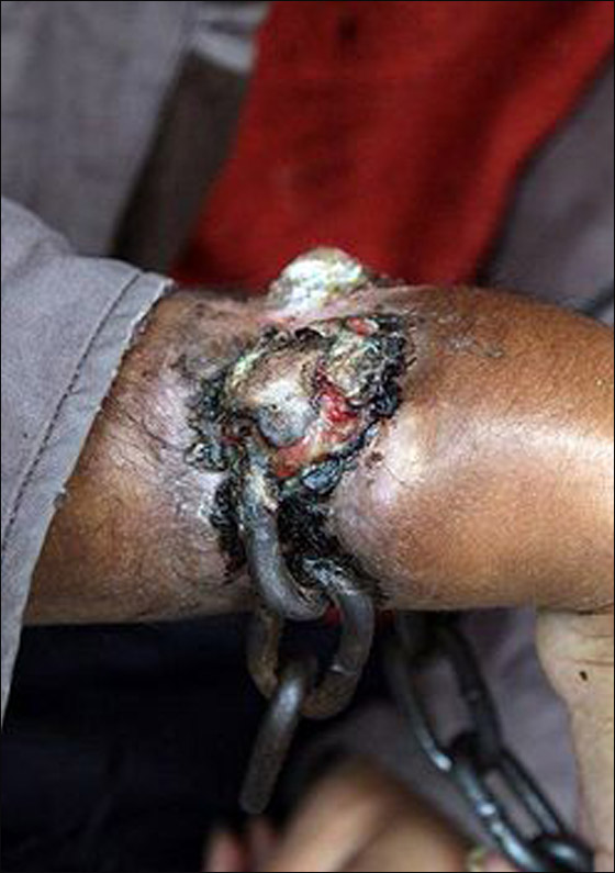 الصين: اما ان يخرج سلسلة من ساعده.. أو يقطع يده!   صورة رقم 2