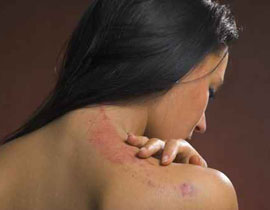 مصر: كوى ابنته بالنار ثم قتلها ودفنها لشكه بأنها سرقت نقوده! صورة رقم 1