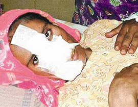 خانت زوجها.. فعاقبوها بقطع أنفها وقص شعرها! صورة رقم 1