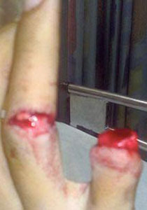 السعودية: عاقبوه ببتر اصبعه والسبب.. ضربة جزاء!! صورة رقم 1