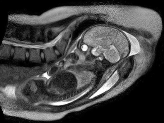 لأول مرة.. تصوير عملية ولادة بالرنين المغناطيسي! صورة رقم 2 لأول مرة.. تصوير عملية ولادة بالرنين المغناطيسي! صورة رقم 2