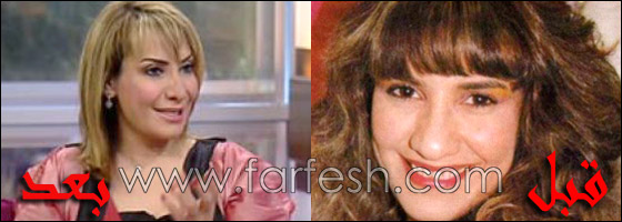 في 2010.. النجمات وعمليات التجميل بين الموضة والاكتئاب! صورة رقم 4 في 2010.. النجمات وعمليات التجميل بين الموضة والاكتئاب! صورة رقم 4