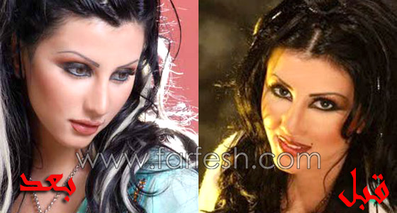 في 2010.. النجمات وعمليات التجميل بين الموضة والاكتئاب! صورة رقم 5 في 2010.. النجمات وعمليات التجميل بين الموضة والاكتئاب! صورة رقم 5