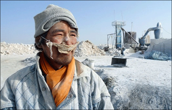 مدير ملجأ صيني يتاجر باشخاص من ذوي الاحتياجات الخاصة!  صورة رقم 3