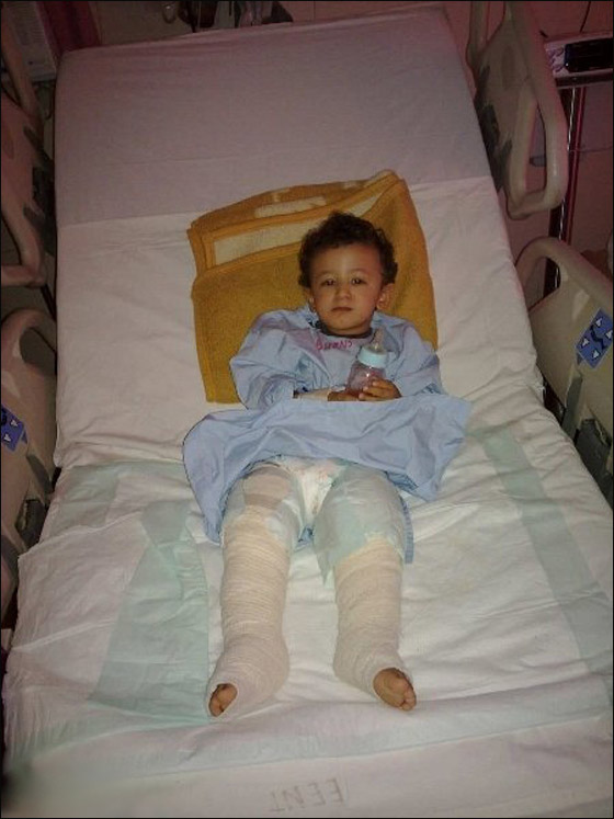 قمة القسوة: خادمة اندونيسية تحرق جسد طفل بالماء الساخن! صورة رقم 1