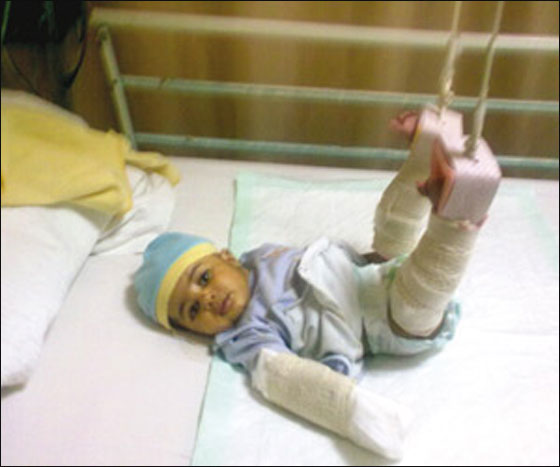 أب سعودي يعتدي على رضيعه ويتركه مشلولا  صورة رقم 3