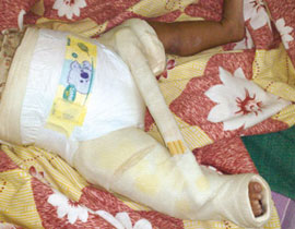 أب سعودي يعتدي على رضيعه ويتركه مشلولا  صورة رقم 2