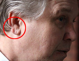 قضمت اذن عشيقها وبصقتها لاطعام كلبها.. والسبب هو الغيرة!! صورة رقم 1 قضمت اذن عشيقها وبصقتها لاطعام كلبها.. والسبب هو الغيرة!! صورة رقم 1