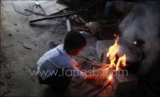 قصة مدهشة عن يتيم ينبذه مجتمعه لمرضه ويعيش وحيدا!  صورة رقم 5