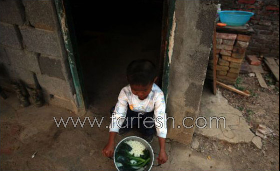 قصة مدهشة عن يتيم ينبذه مجتمعه لمرضه ويعيش وحيدا!  صورة رقم 1