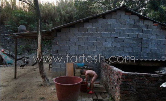 قصة مدهشة عن يتيم ينبذه مجتمعه لمرضه ويعيش وحيدا!  صورة رقم 3