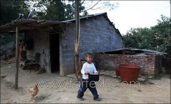 قصة مدهشة عن يتيم ينبذه مجتمعه لمرضه ويعيش وحيدا!  صورة رقم 4