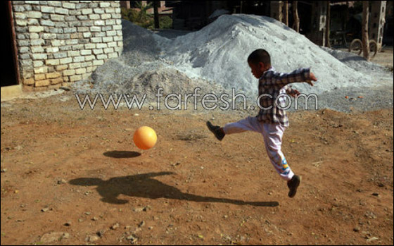 قصة مدهشة عن يتيم ينبذه مجتمعه لمرضه ويعيش وحيدا!  صورة رقم 10