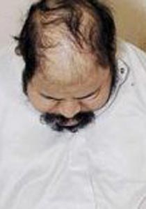 خطأ موظف بالطباعة يفقد مريضا عربيا بصره! صورة رقم 1