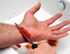 قطع عضوه الذكري وخصيتيه تبعا لتعاويذ الشعوذة!! صورة رقم 1