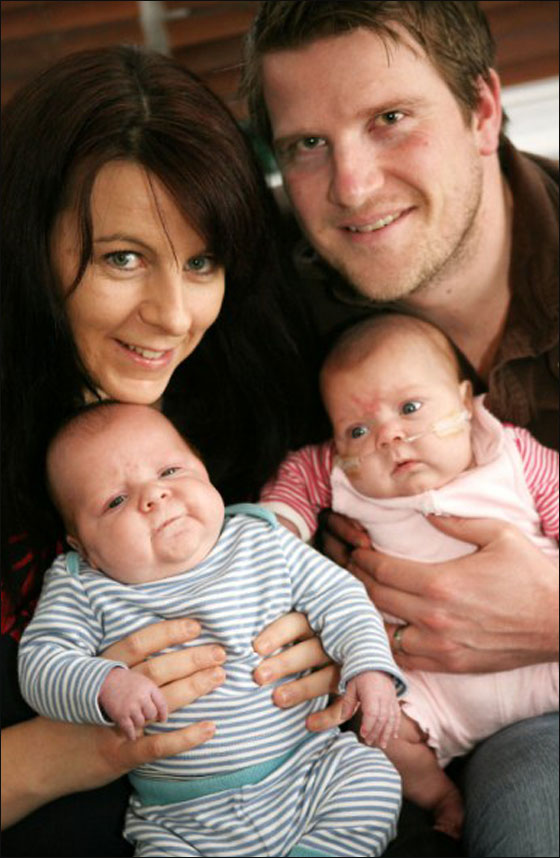 توأمان خديجان انقطع نفسهما خلال الولادة اكثر من 100 مرة! صورة رقم 2 توأمان خديجان انقطع نفسهما خلال الولادة اكثر من 100 مرة! صورة رقم 2