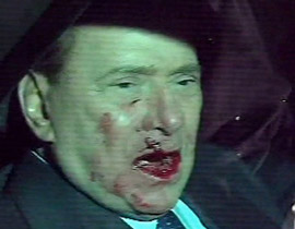 بعد الهجوم الاليم عليه.. برلسكوني يخضع لجراحة في عظام الفك  صورة رقم 1