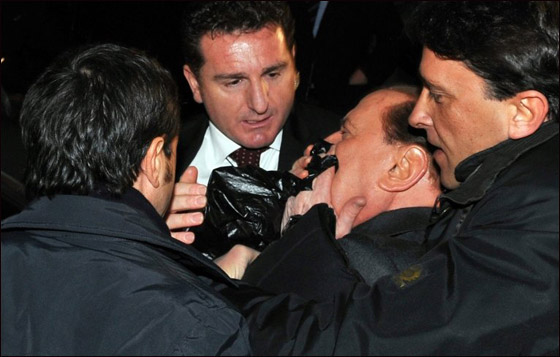 بعد الهجوم الاليم عليه.. برلسكوني يخضع لجراحة في عظام الفك  صورة رقم 3