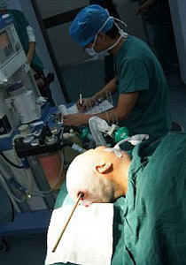 نجت باعجوبة بعدما اخترق سيخ دماغها إلى عمق 8 سنتيمترات صورة رقم 1 نجت باعجوبة بعدما اخترق سيخ دماغها إلى عمق 8 سنتيمترات صورة رقم 1