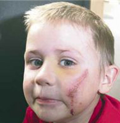 شاب يقذف حجرا من فوق الجسر ويصيب طفلا داخل سيارة بوجهه صورة رقم 3