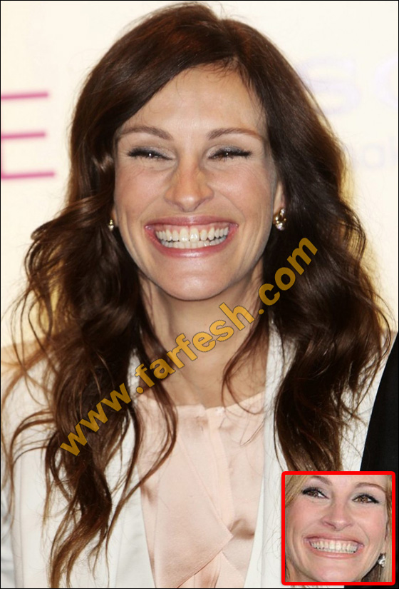 عيوب جسدية وتشوهات خلقية لدى النجمات العالميات الشهيرات! صورة رقم 5 عيوب جسدية وتشوهات خلقية لدى النجمات العالميات الشهيرات! صورة رقم 5