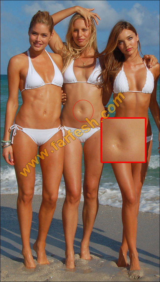 عيوب جسدية وتشوهات خلقية لدى النجمات العالميات الشهيرات! صورة رقم 8 عيوب جسدية وتشوهات خلقية لدى النجمات العالميات الشهيرات! صورة رقم 8