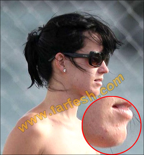 عيوب جسدية وتشوهات خلقية لدى النجمات العالميات الشهيرات! صورة رقم 6 عيوب جسدية وتشوهات خلقية لدى النجمات العالميات الشهيرات! صورة رقم 6