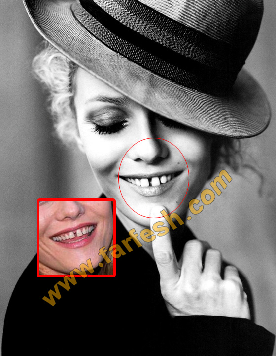 عيوب جسدية وتشوهات خلقية لدى النجمات العالميات الشهيرات! صورة رقم 4 عيوب جسدية وتشوهات خلقية لدى النجمات العالميات الشهيرات! صورة رقم 4