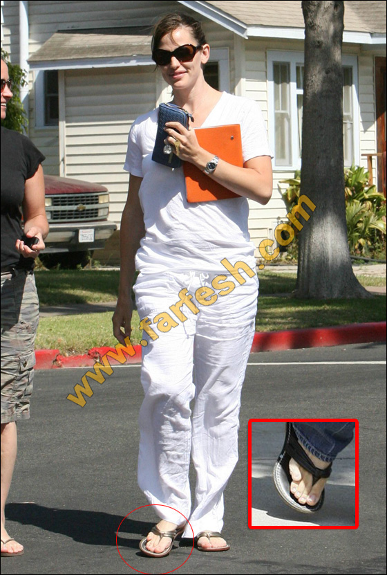 عيوب جسدية وتشوهات خلقية لدى النجمات العالميات الشهيرات! صورة رقم 7 عيوب جسدية وتشوهات خلقية لدى النجمات العالميات الشهيرات! صورة رقم 7