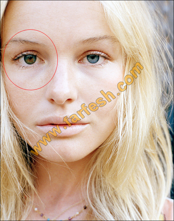 عيوب جسدية وتشوهات خلقية لدى النجمات العالميات الشهيرات! صورة رقم 3 عيوب جسدية وتشوهات خلقية لدى النجمات العالميات الشهيرات! صورة رقم 3