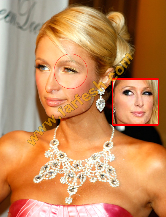 عيوب جسدية وتشوهات خلقية لدى النجمات العالميات الشهيرات! صورة رقم 1 عيوب جسدية وتشوهات خلقية لدى النجمات العالميات الشهيرات! صورة رقم 1