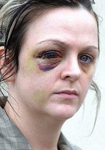 الممثلة شارلوت ديفيس تصاب بالعمى بسبب.. كأس نبيذ!! صورة رقم 1