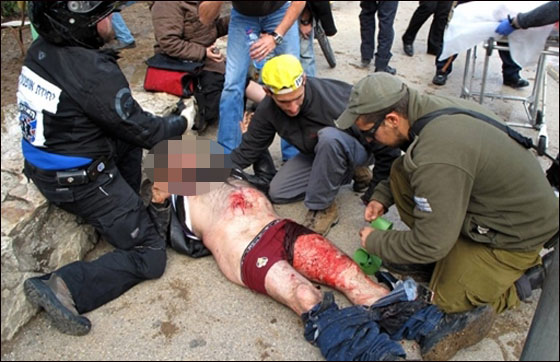 قتيلة وأكثر من 30 مصابا اسرائيليا في عملية تفجير في القدس صورة رقم 1 قتيلة وأكثر من 30 مصابا اسرائيليا في عملية تفجير في القدس صورة رقم 1