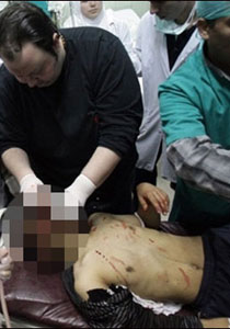 الأمن السوري يقمع المعتصمين وأكثر من 25 قتيلا في درعا صورة رقم 1 الأمن السوري يقمع المعتصمين وأكثر من 25 قتيلا في درعا صورة رقم 1