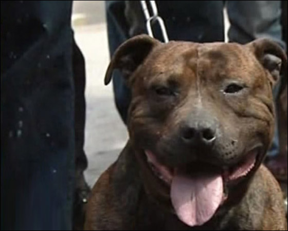 طفلة تفقد قدمها اليسرى بسبب عضّة كلب طفلة تفقد قدمها اليسرى بسبب عضّة كلب