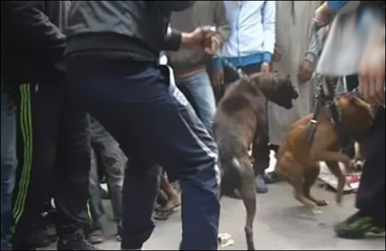 طفلة تفقد قدمها اليسرى بسبب عضّة كلب طفلة تفقد قدمها اليسرى بسبب عضّة كلب