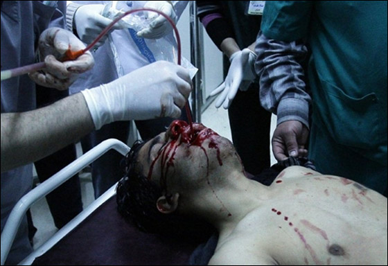 اكثر من 100 قتيل بدرعا والامن السوري ينسحب من مسجد العمري! صورة رقم 10 اكثر من 100 قتيل بدرعا والامن السوري ينسحب من مسجد العمري! صورة رقم 10